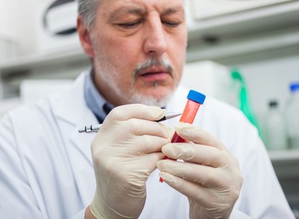 Bajt jelent, ha ezt kimutatják a vérben: a tudósok egy korai Parkinson-kór jelet találtak című cikk nyitóképe