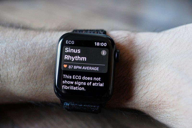 Értékelhető EKG-t készít-e az ilyen okosóra? Az orvos válaszol
