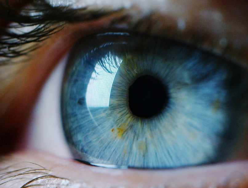 Mitől jelentek meg sötét foltok a szememben