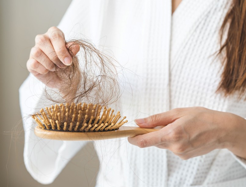 PCOS tünet hízás hajhullás pattanás