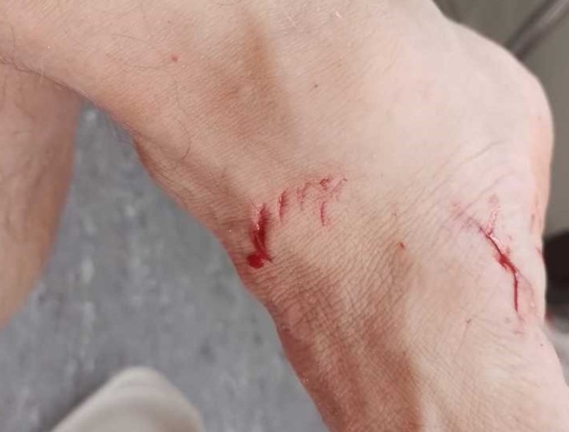 cápa támadás jele úszás fürdés közben tenger