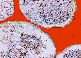 Fertőzések - terhesség idején