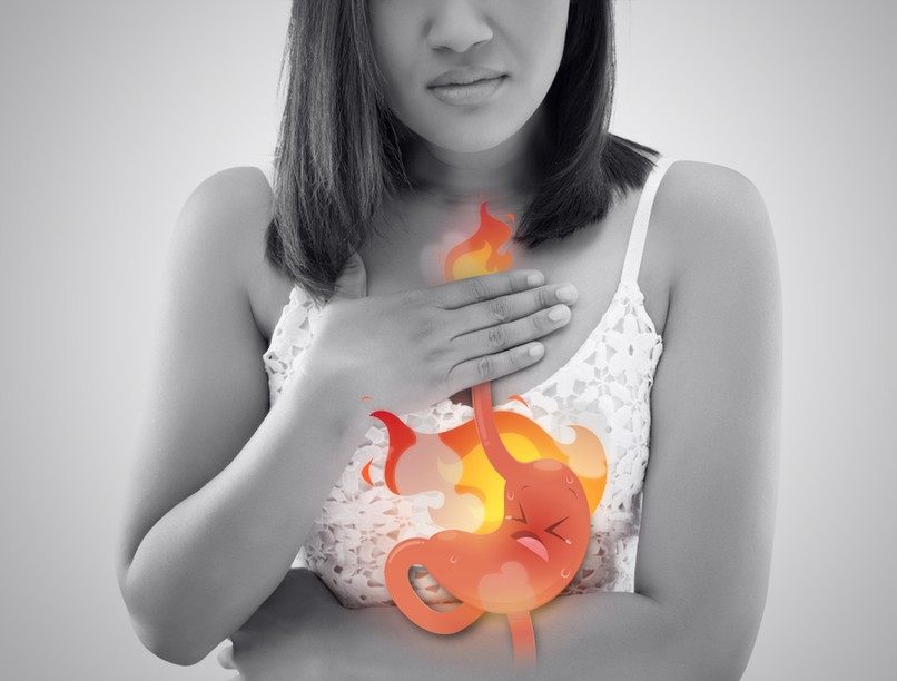 reflux, gyomorégés, hormonális zavar, gyomorsüllyedés