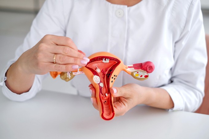 Mióma: jóindulatú daganat, amely néha nagyon is rosszindulatúan viselkedik című cikk nyitóképe