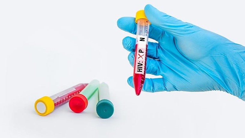 hiv