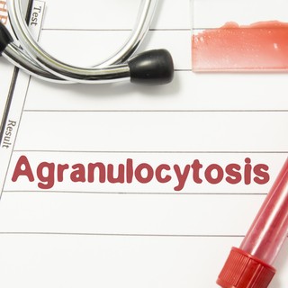 Agranulocitózis tünetei, vizsgálata és kezelése című cikk nyitóképe