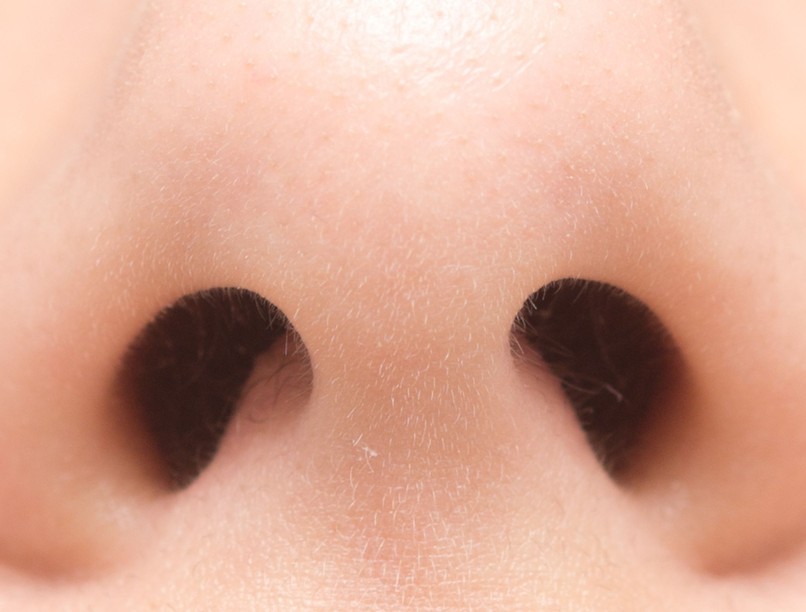 orrlyuk, szaglás, orrdugulás