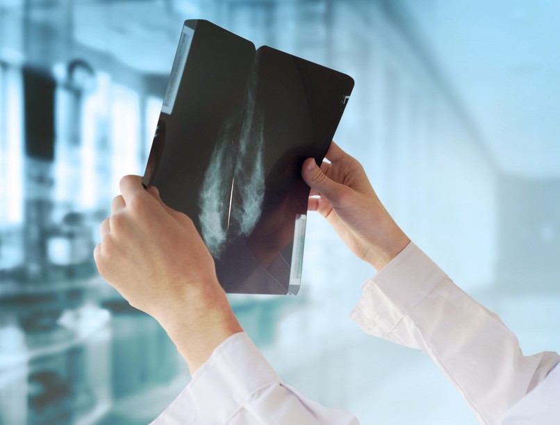 emlőrák mellrák megtévesztő tünet jel