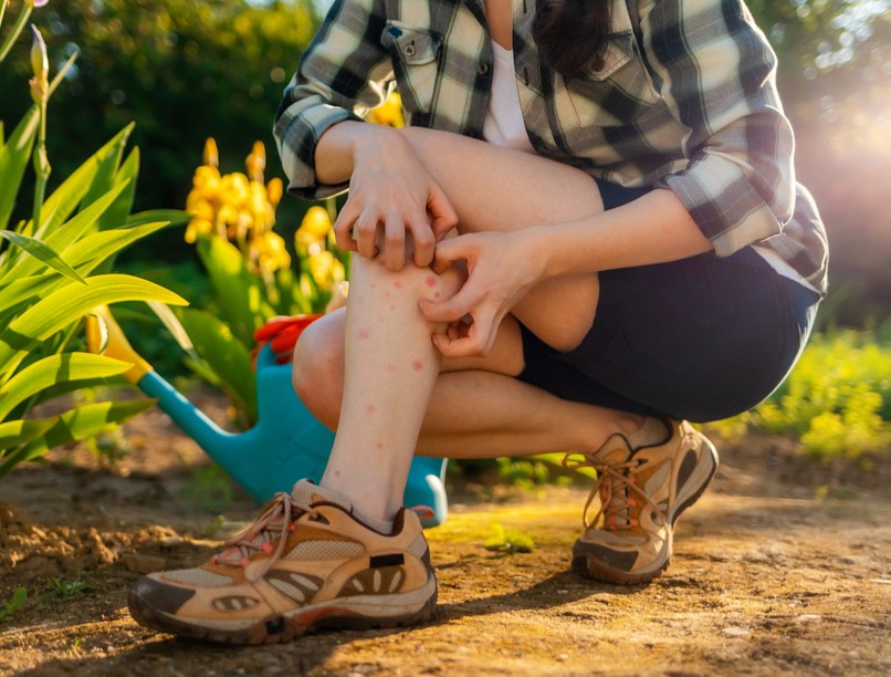 szúnyogcsípés vakar miért ne