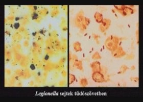 Figyelem! Cink-oxid és a rákkeltő hatás