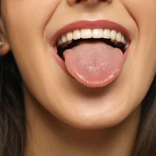 Ki nem találná, hol jelennek meg először a plusz kilók – nem a hasán és nem is a fenekén című cikk nyitóképe