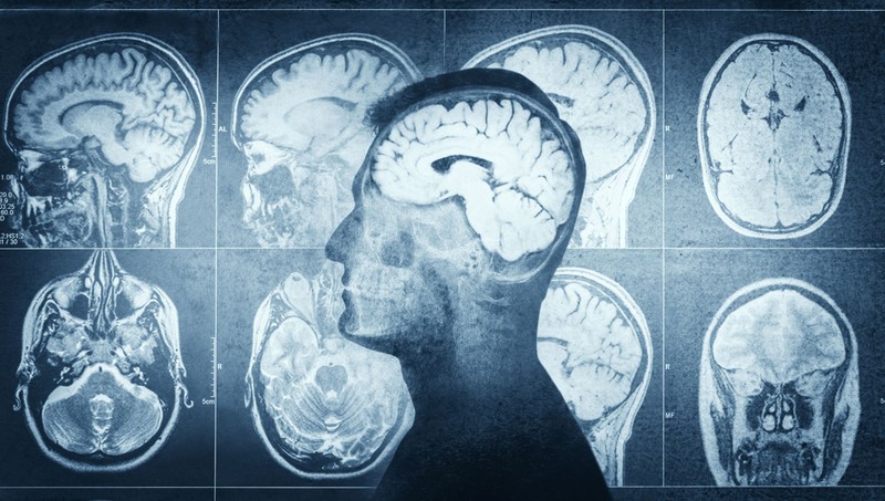 4 mindennapi szokás, amely észrevétlenül felgyorsíthatja az agy öregedését