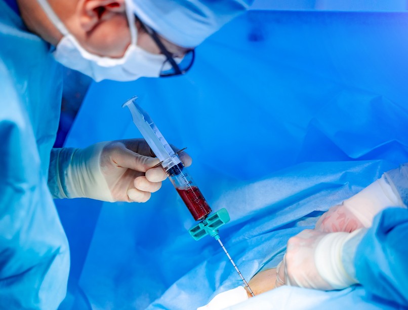 csontvelő-transzplantáció hematopoetikus őssejt-transzplantáció leírás