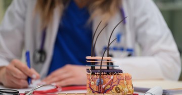  Zavaró kinövések a bőrön - innen tudhatja, hogy fibróma vagy szemölcs okozza 