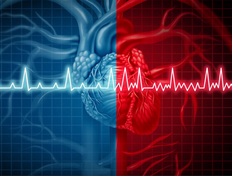 szívritmuszavar, pitvarfibrilláció, mellkasi fájdalom, szívbetegség, szívritmusszabályzó gyógyszerek