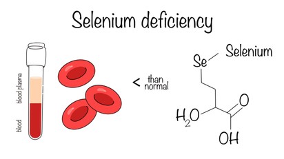 Szelénhiány tünetei, vizsgálata és kezelési lehetőségei című cikk nyitóképe