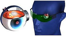 Új remény vakok számára: a bionikus szem