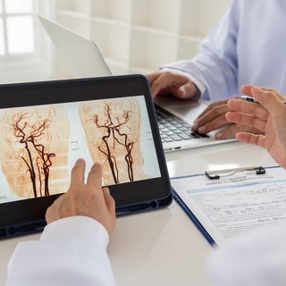 Stroke: ha ezeket a tüneteket érzi, már veszélyben van! című cikk nyitóképe
