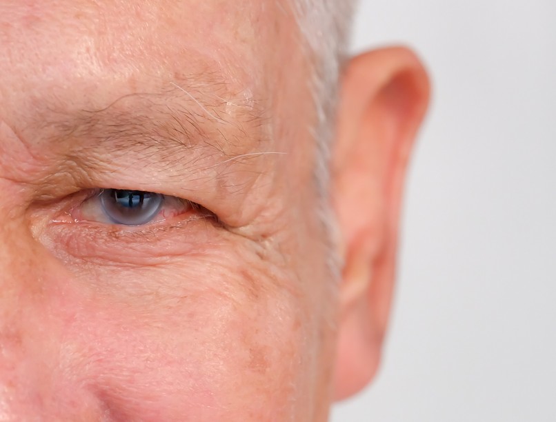 Mi a zöldhályog műtét