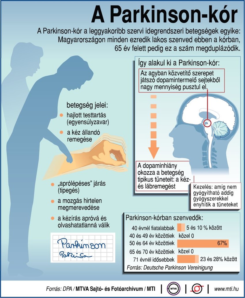 A Parkinson-kór tünetei