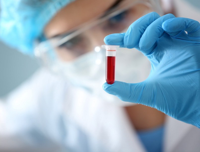 panelvizsgálat vérvétel pajzsmirigy pajzsmirigyzavar