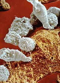 Könnyebb a megelőzés - mint a gyógyítás (nemcsak daganatok esetén)