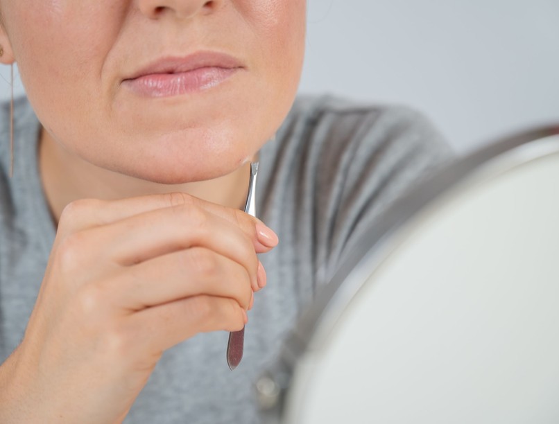 mitől szőrösödik az áll arc