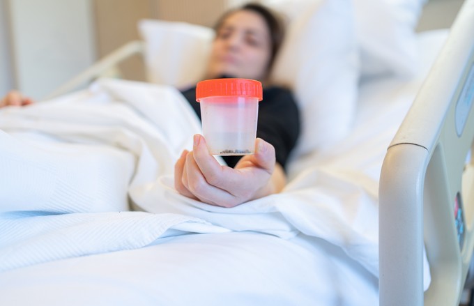 Vesekő esetén nem mindegy, hogy milyen diétát követ, és az sem, milyen típusú a veseköve! című cikk nyitóképe