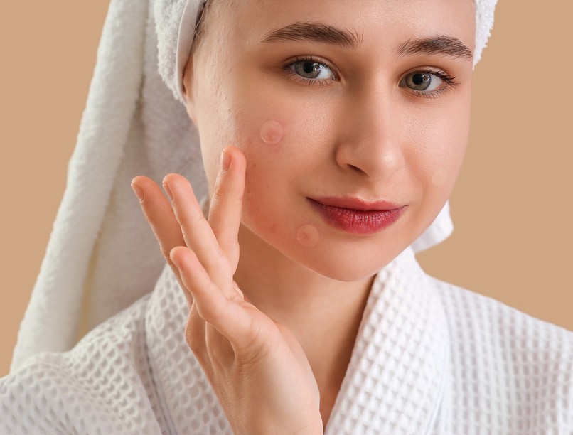 akné pattanás mikor kell orvoshoz menni