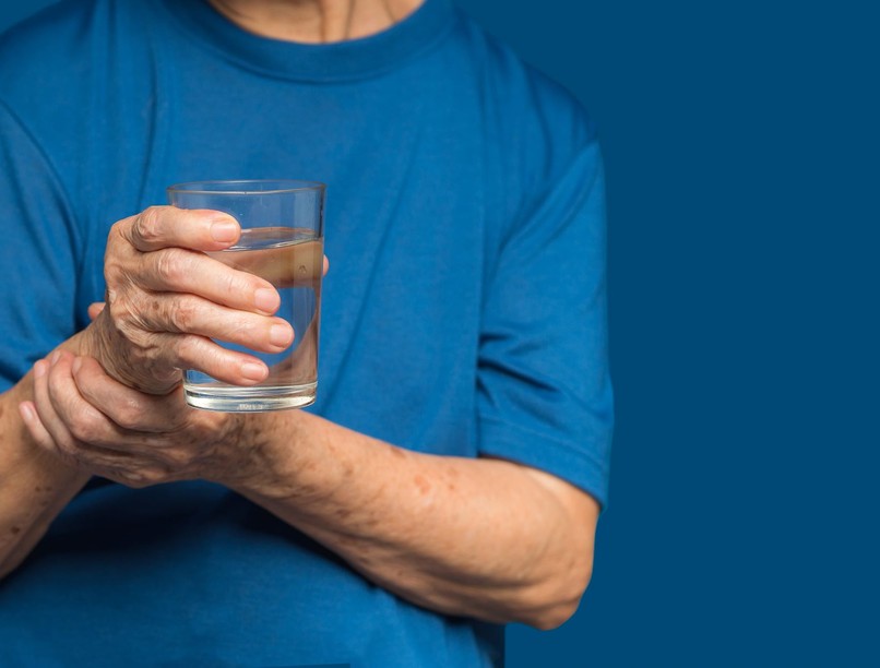 Parkinson-kór korai tünet szaglás