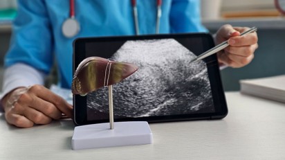 Hogyan gyógyítható a májrák? A modern onkológia valódi lehetőségei és korlátai  című cikk nyitóképe