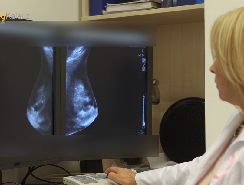 Mesterseges intelligenciaval az emlorak kiszureseert