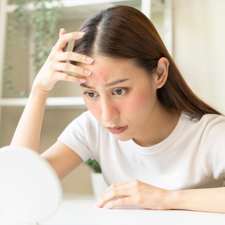 Súlyos autoimmun betegséget jelezhet az, ha így pirosodik ki az arcbőre című cikk nyitóképe