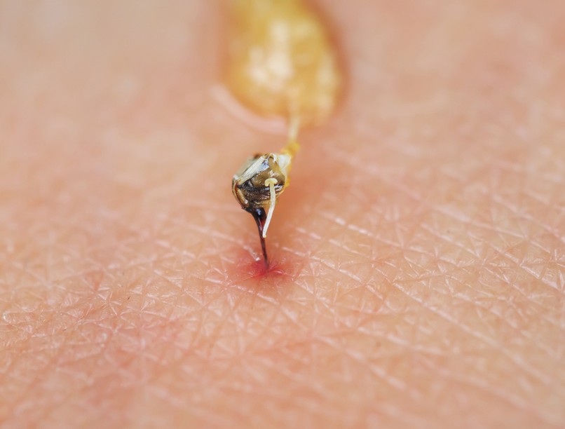 méhcsípés, darázscsípés, csípés, allergia