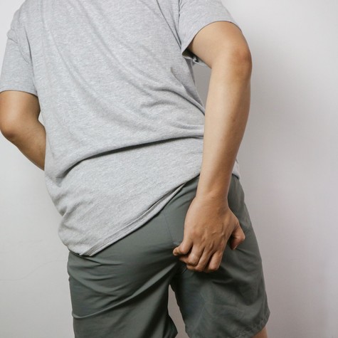 Kellemetlen, de érdemes beszélni róla: ezért viszkethet a hátsó fele című cikk nyitóképe