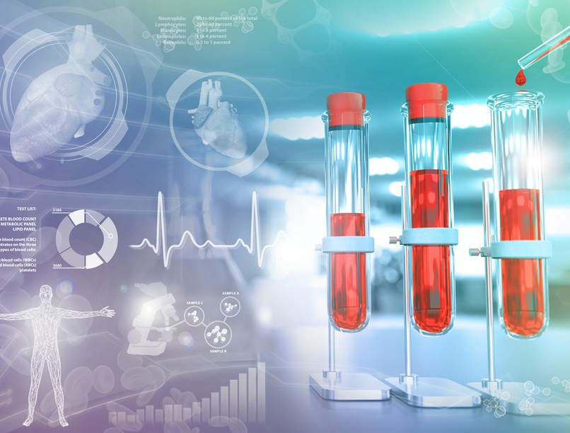 koronavírus, koleszterin, sztatin, magas vérnyomás