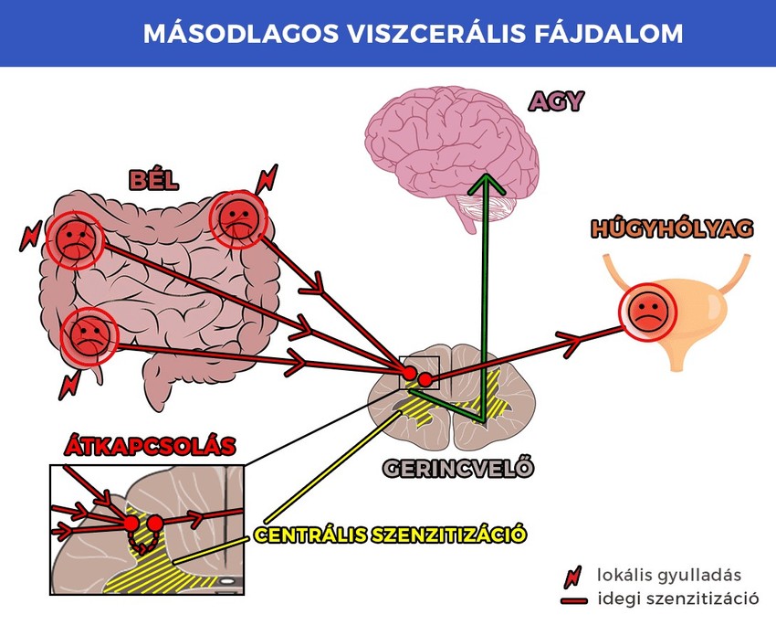 A mozgásszervi panaszok kivizsgálásakor a belső szervek állapotára is figyelni kell