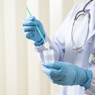 Méhnyakrák szűrés esetén ezért fontos a HPV teszt is című cikk nyitóképe