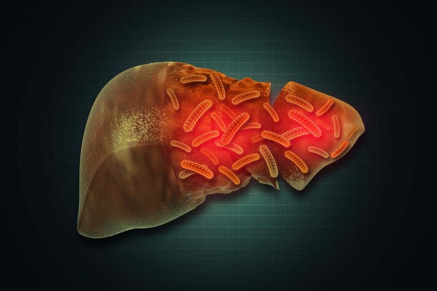 A máj parazitái súlyos szövődményekhez, anyagcserezavarokhoz, előrehaladott esetekben pedig halálhoz vezetnek.Sokféle tünet árulkodik az élősködők jelenlétéről - mutatjuk, melyek ezek.