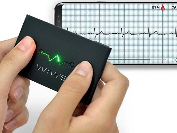 Hát az ön EKG-ja milyen? Mérje meg otthon!