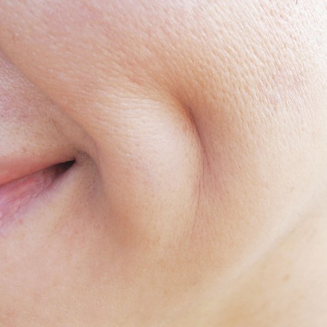 Miért vannak egyeseknek születésük óta gödröcskék az arcukon – és mit üzen ez a különleges vonás? című cikk nyitóképe