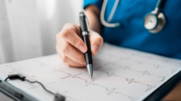 Mit árul el a szívéről az EKG első kis hulláma? Ezt jelenti a P-hullám című cikk nyitóképe