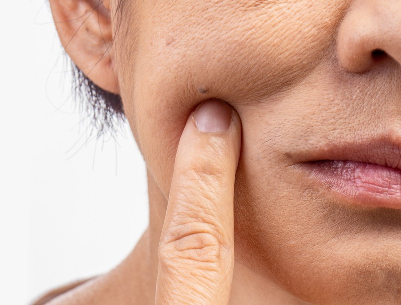 daganatos betegségek öregedés