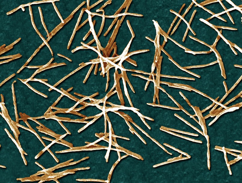 fuzobakterium hatása rákos sejtekre