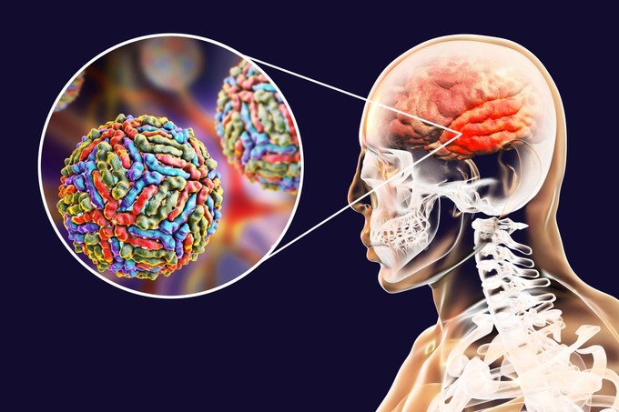 Nyugat-nílusi láz: Magyarországon kirívóan sok a beteg című cikk nyitóképe