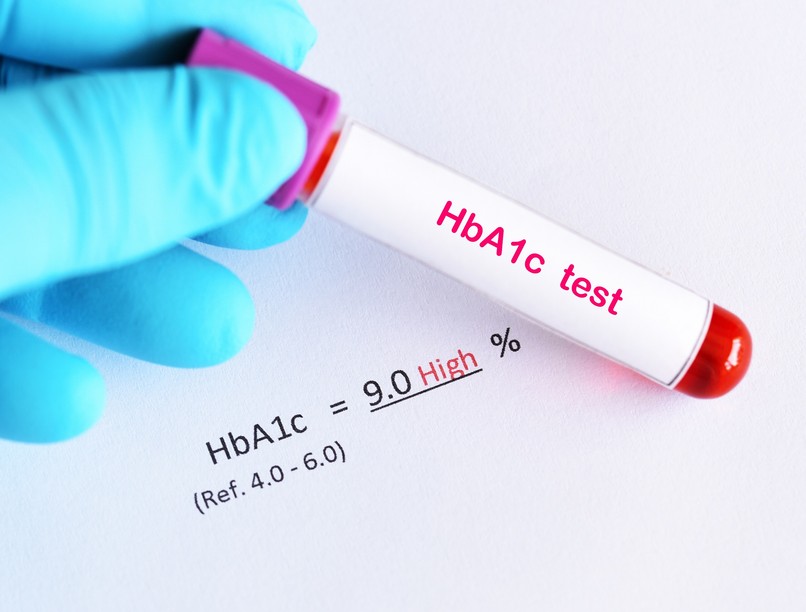 mit jelent magas HbA1c érték csökkentés cukorbetegség