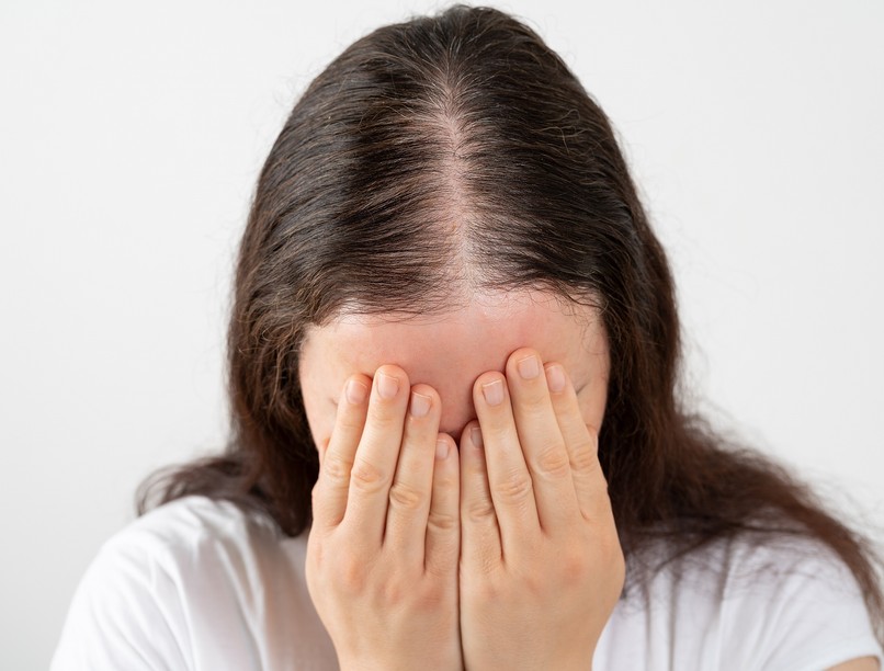 hajhullás, oka, pcos, inzulinrezisztencia orvos válaszol