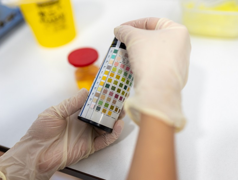 Mit jelez vizeletszín laborlelet