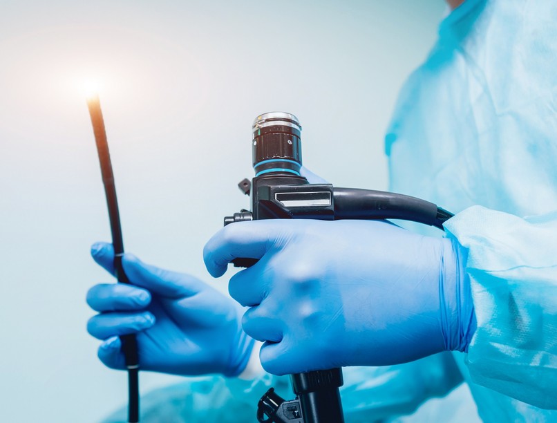 kolonoszkópia, vastagbélrák, vastagbéltükrözés, fájdalom