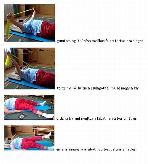 Parkinson-kór gyógytorna kezelése (2. rész)